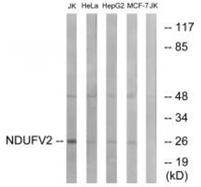 Western blot - NDUFV2 Antibody from Signalway Antibody (34833) - Antibodies.com