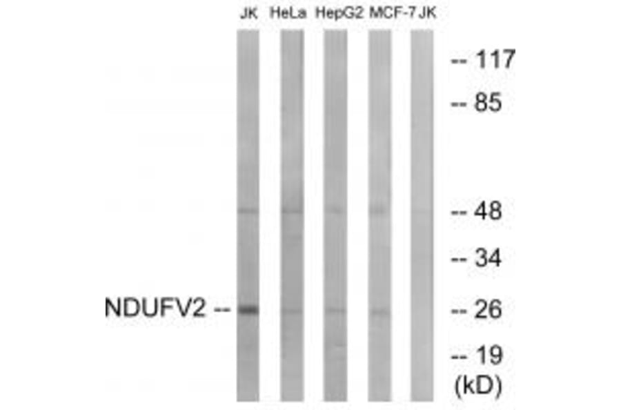 Western blot - NDUFV2 Antibody from Signalway Antibody (34833) - Antibodies.com