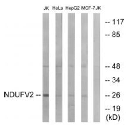 Western blot - NDUFV2 Antibody from Signalway Antibody (34833) - Antibodies.com