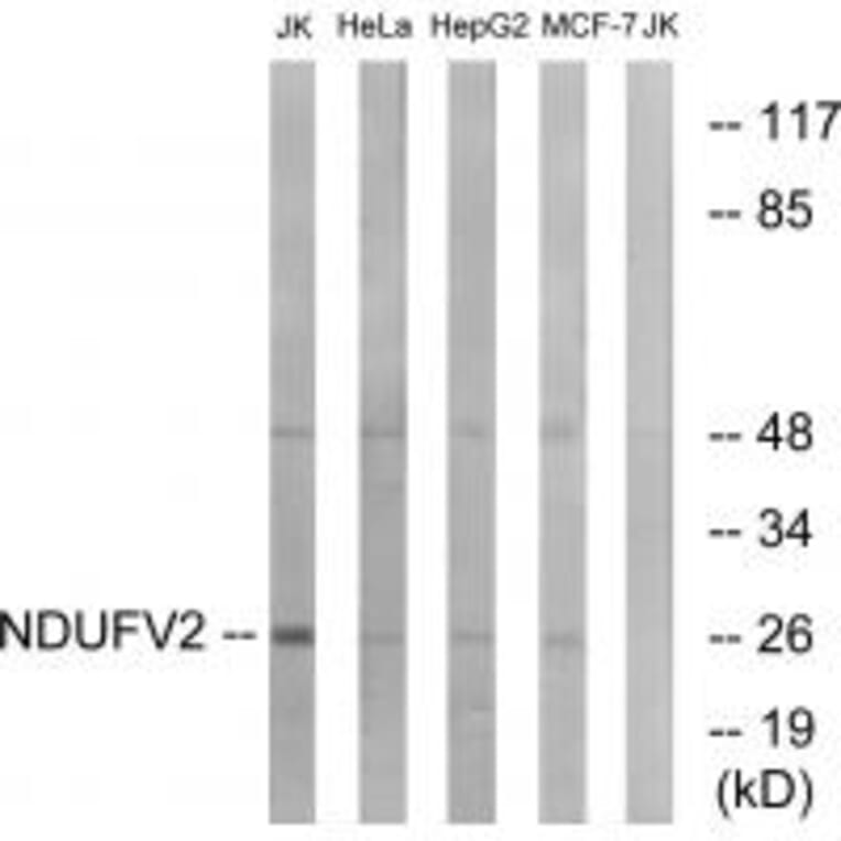 Western blot - NDUFV2 Antibody from Signalway Antibody (34833) - Antibodies.com