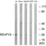 Western blot - NDUFV2 Antibody from Signalway Antibody (34833) - Antibodies.com