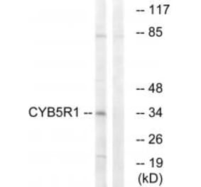 Western blot - CYB5R1 Antibody from Signalway Antibody (34836) - Antibodies.com