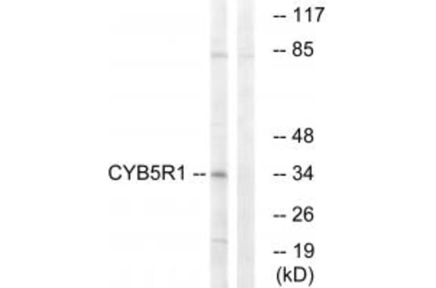 Western blot - CYB5R1 Antibody from Signalway Antibody (34836) - Antibodies.com