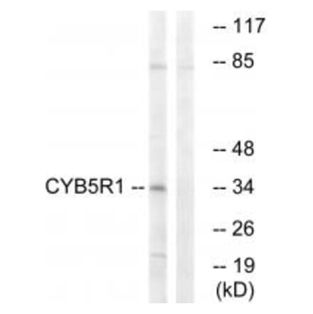 Western blot - CYB5R1 Antibody from Signalway Antibody (34836) - Antibodies.com
