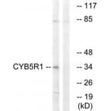 Western blot - CYB5R1 Antibody from Signalway Antibody (34836) - Antibodies.com