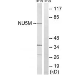Western blot - MT-ND5 Antibody from Signalway Antibody (34840) - Antibodies.com