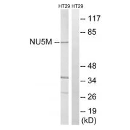 Western blot - MT-ND5 Antibody from Signalway Antibody (34840) - Antibodies.com