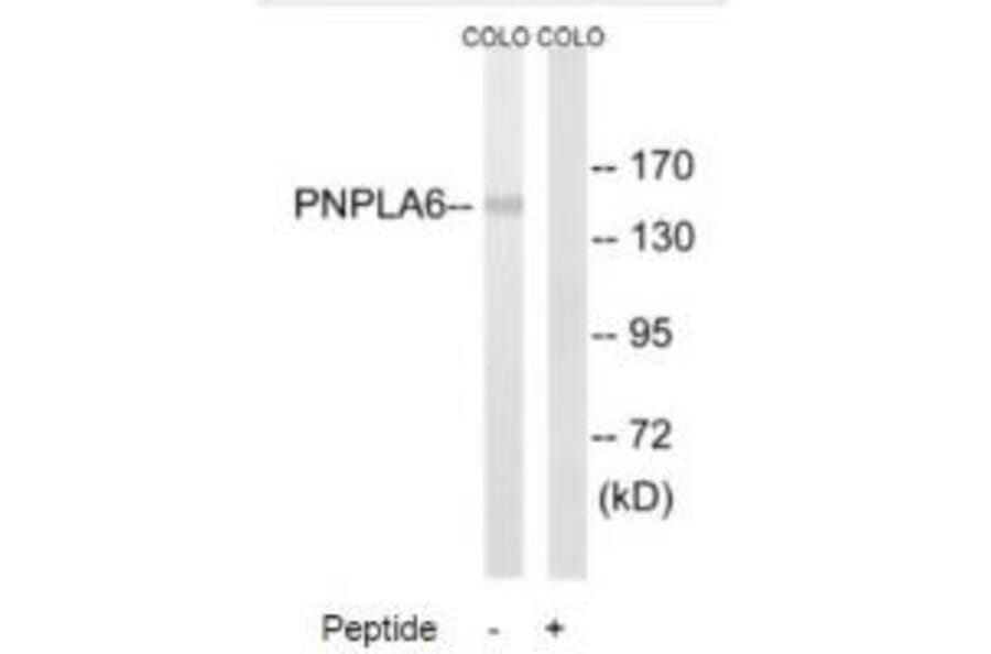 Western blot - PNPLA6 Antibody from Signalway Antibody (34862) - Antibodies.com