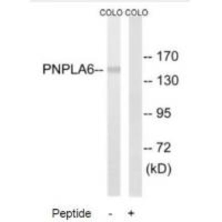 Western blot - PNPLA6 Antibody from Signalway Antibody (34862) - Antibodies.com