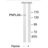 Western blot - PNPLA6 Antibody from Signalway Antibody (34862) - Antibodies.com