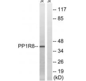 Western blot - PPP1R8 Antibody from Signalway Antibody (34868) - Antibodies.com