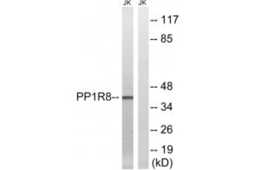 Western blot - PPP1R8 Antibody from Signalway Antibody (34868) - Antibodies.com