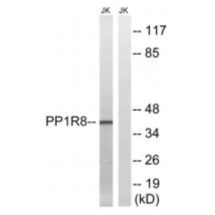 Western blot - PPP1R8 Antibody from Signalway Antibody (34868) - Antibodies.com