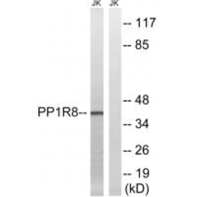 Western blot - PPP1R8 Antibody from Signalway Antibody (34868) - Antibodies.com