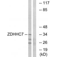 Western blot analysis of extracts from HUVEC cells, using ZDHHC7 antibody #34888.