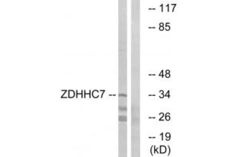 Western blot - ZDHHC7 Antibody from Signalway Antibody (34888) - Antibodies.com