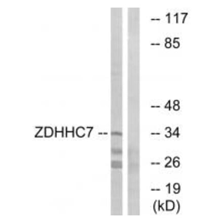 Western blot - ZDHHC7 Antibody from Signalway Antibody (34888) - Antibodies.com