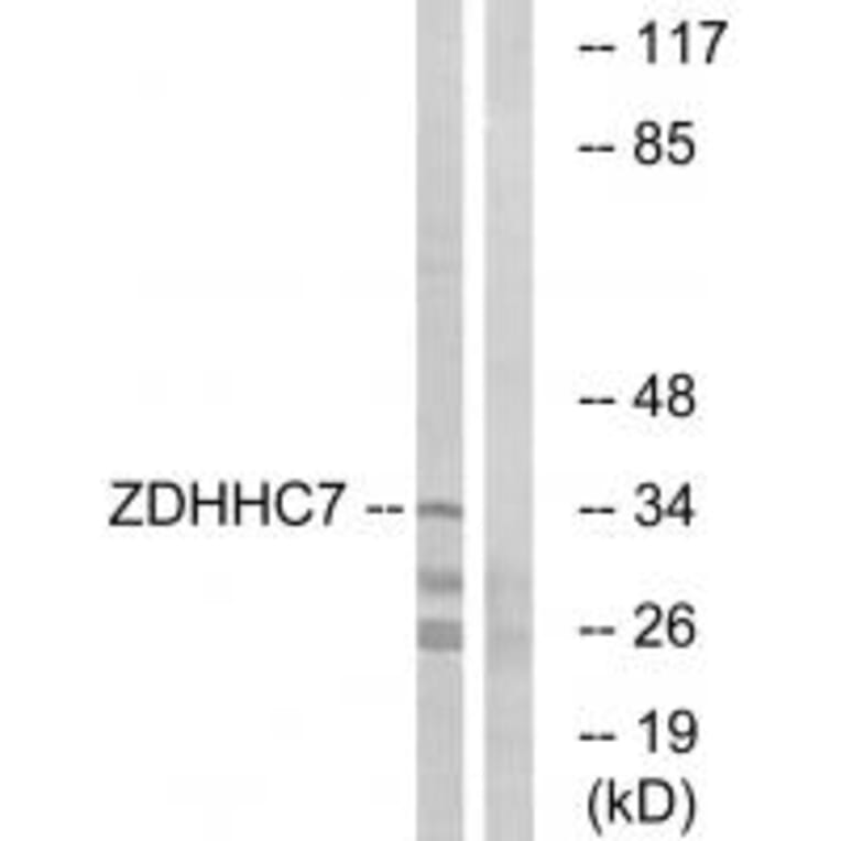 Western blot - ZDHHC7 Antibody from Signalway Antibody (34888) - Antibodies.com