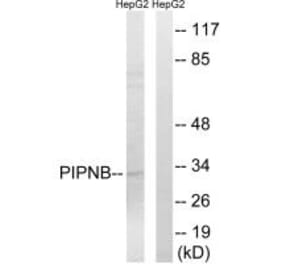 Western blot - PITPNB Antibody from Signalway Antibody (34902) - Antibodies.com