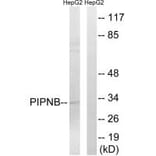Western blot - PITPNB Antibody from Signalway Antibody (34902) - Antibodies.com