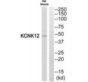 Western blot - KCNK12 Antibody from Signalway Antibody (34911) - Antibodies.com