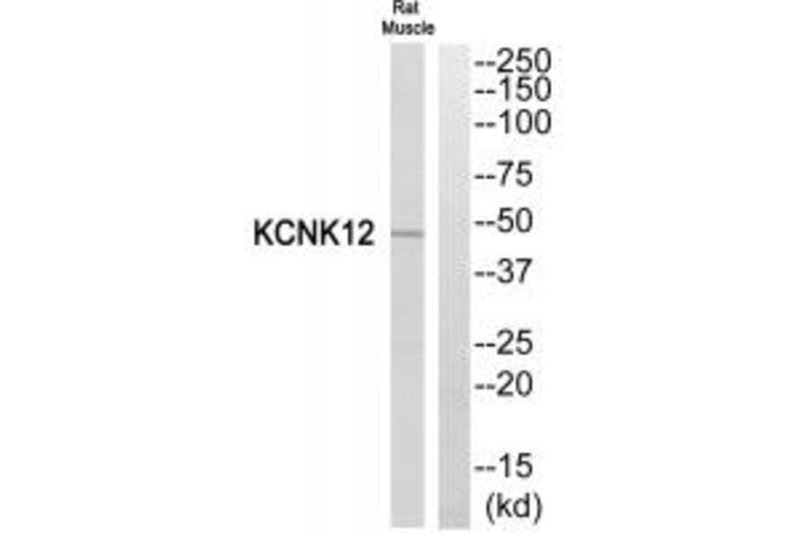 Western blot - KCNK12 Antibody from Signalway Antibody (34911) - Antibodies.com