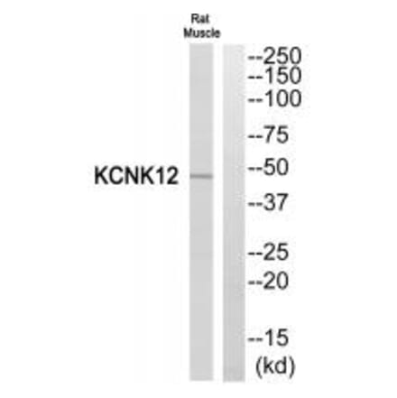 Western blot - KCNK12 Antibody from Signalway Antibody (34911) - Antibodies.com
