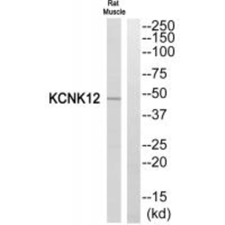 Western blot - KCNK12 Antibody from Signalway Antibody (34911) - Antibodies.com