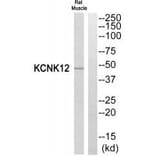 Western blot - KCNK12 Antibody from Signalway Antibody (34911) - Antibodies.com