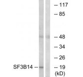 Western blot - SF3B14 Antibody from Signalway Antibody (34922) - Antibodies.com