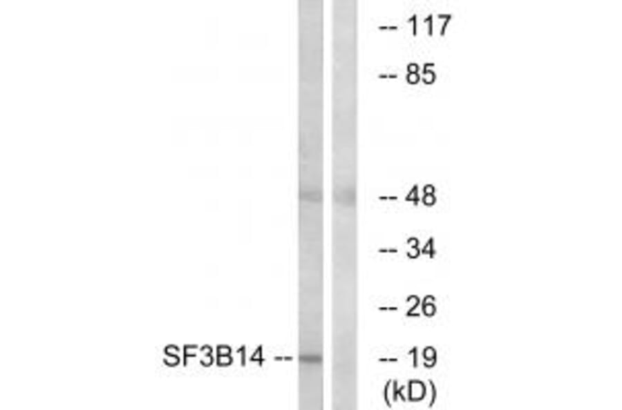 Western blot - SF3B14 Antibody from Signalway Antibody (34922) - Antibodies.com