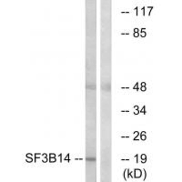 Western blot - SF3B14 Antibody from Signalway Antibody (34922) - Antibodies.com