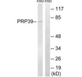 Western blot - PRPF39 Antibody from Signalway Antibody (34924) - Antibodies.com