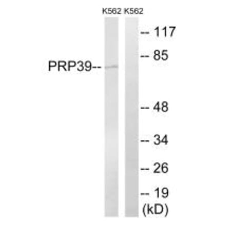 Western blot - PRPF39 Antibody from Signalway Antibody (34924) - Antibodies.com