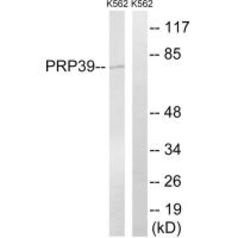 Western blot - PRPF39 Antibody from Signalway Antibody (34924) - Antibodies.com