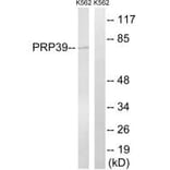 Western blot - PRPF39 Antibody from Signalway Antibody (34924) - Antibodies.com