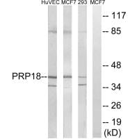 Western blot analysis of extracts from HuvEc cells, MCF-7 cells and 293 cells, using PRPF18 antibody #34925.