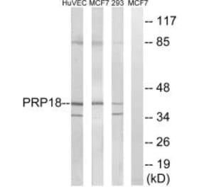 Western blot - PRPF18 Antibody from Signalway Antibody (34925) - Antibodies.com