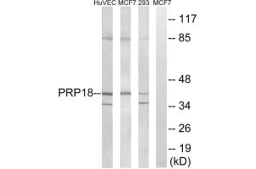 Western blot - PRPF18 Antibody from Signalway Antibody (34925) - Antibodies.com