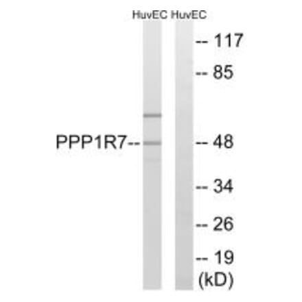 Western blot - PPP1R7 Antibody from Signalway Antibody (34933) - Antibodies.com