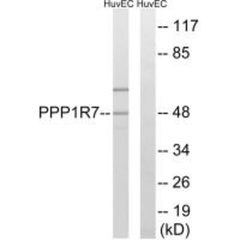 Western blot - PPP1R7 Antibody from Signalway Antibody (34933) - Antibodies.com