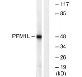 Western blot - PPM1L Antibody from Signalway Antibody (34934) - Antibodies.com