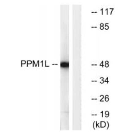 Western blot - PPM1L Antibody from Signalway Antibody (34934) - Antibodies.com