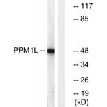 Western blot - PPM1L Antibody from Signalway Antibody (34934) - Antibodies.com