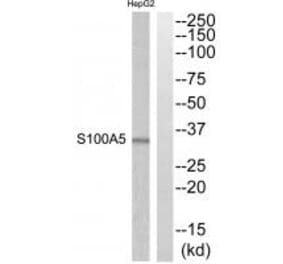 Western blot - S100A5 Antibody from Signalway Antibody (34937) - Antibodies.com