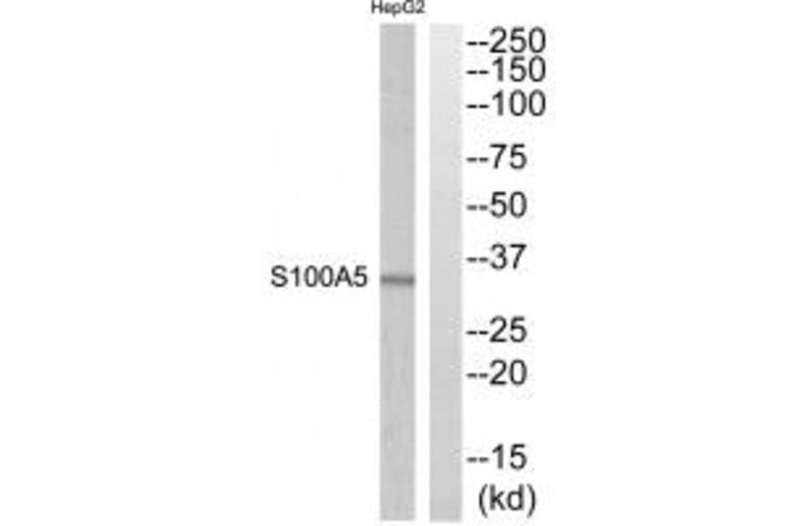 Western blot - S100A5 Antibody from Signalway Antibody (34937) - Antibodies.com