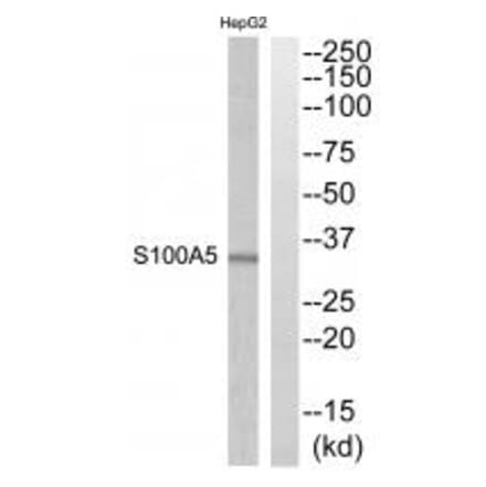 Western blot - S100A5 Antibody from Signalway Antibody (34937) - Antibodies.com