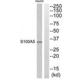 Western blot - S100A5 Antibody from Signalway Antibody (34937) - Antibodies.com