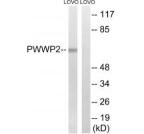 Western blot - PWWP2B Antibody from Signalway Antibody (34941) - Antibodies.com