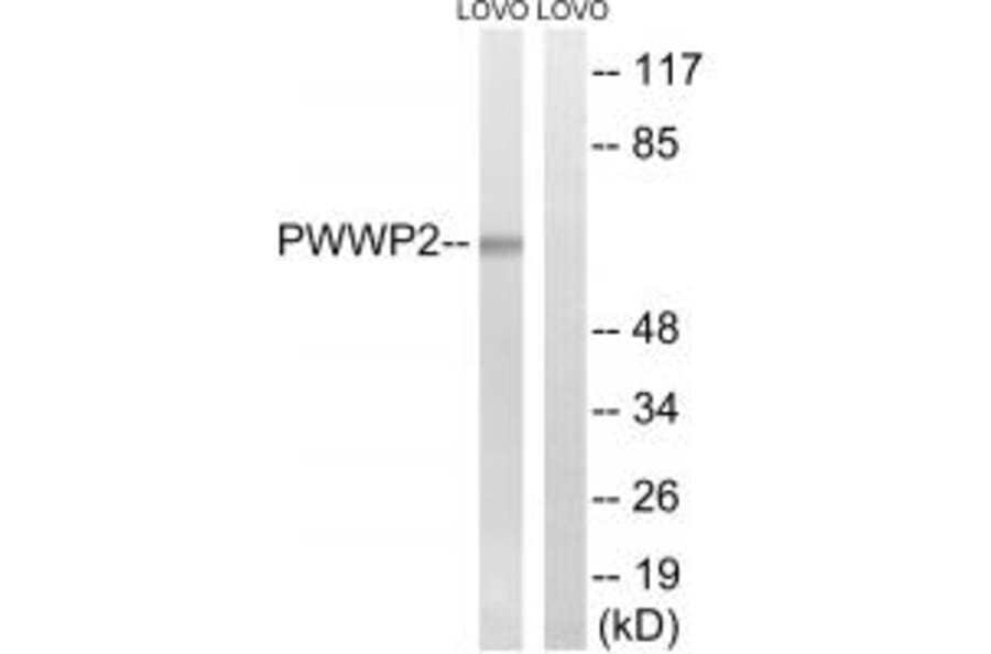 Western blot - PWWP2B Antibody from Signalway Antibody (34941) - Antibodies.com